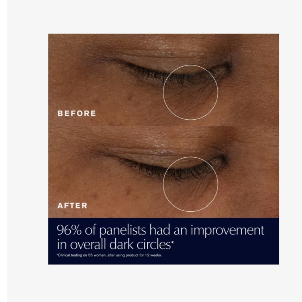 NEW Estee Advanced Night Repair Eye Supercharged Complex Synchronized Recovery - Picture 3 of 7